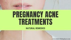 best- Pregnancy Acne Treatment