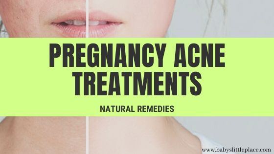 best-pregnancy-acne-treatment | BABY'S LITTLE PLACE